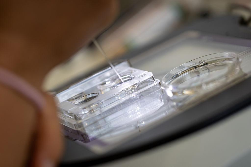 Childhood cancer risk may be higher after some fertility treatments, study finds — FOX 13 Tampa Bay News